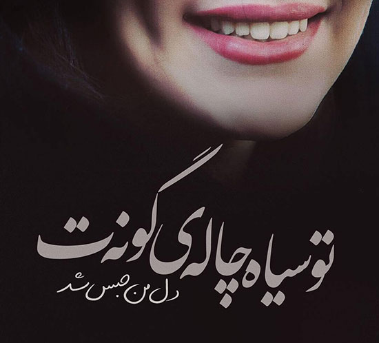 شعر چال گونه